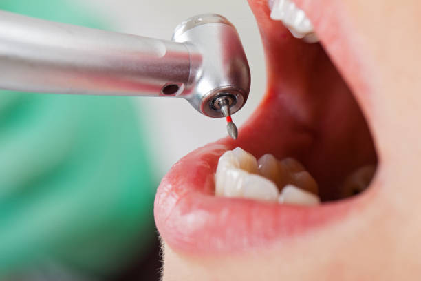 Best Urgent Dental Care for Toothache in Kearns, UT